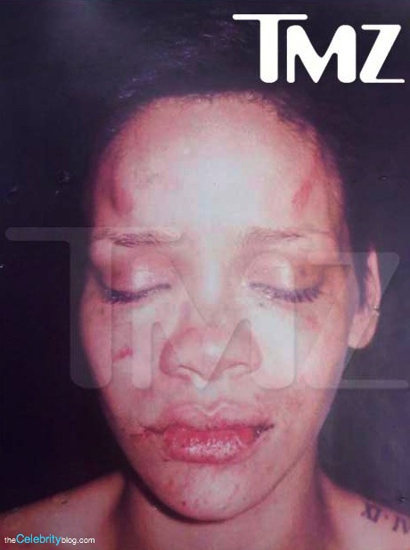 rihanna pictures after beating. Chris Brown gave Rihanna the